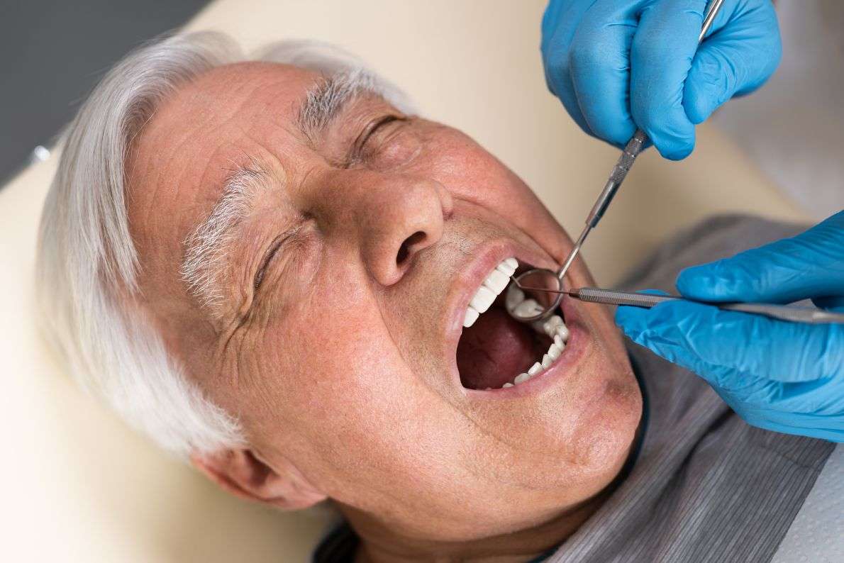 How Long Do White Fillings Last?