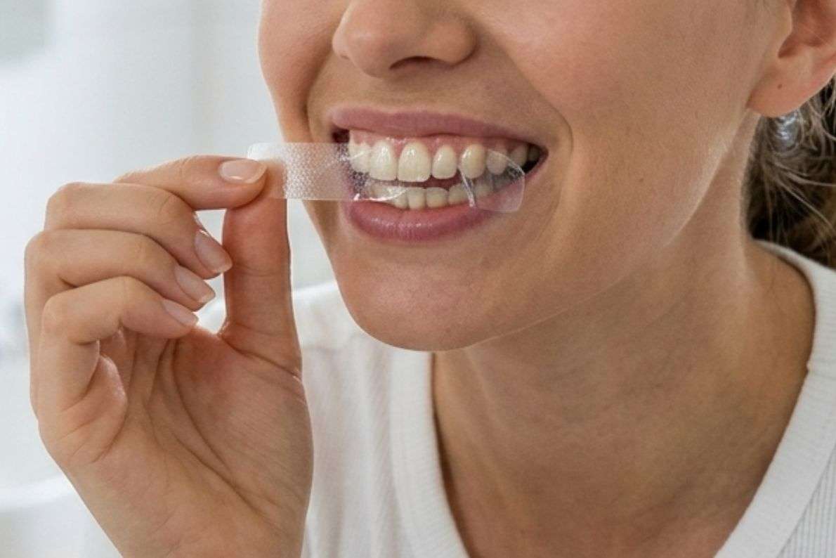 Professional Whitening Gel vs Shop-Bought Strips