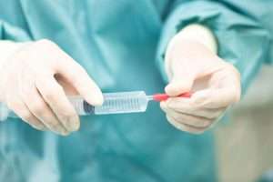 What Anaesthetic Is Used for Surgical Tooth Extraction - StormDental