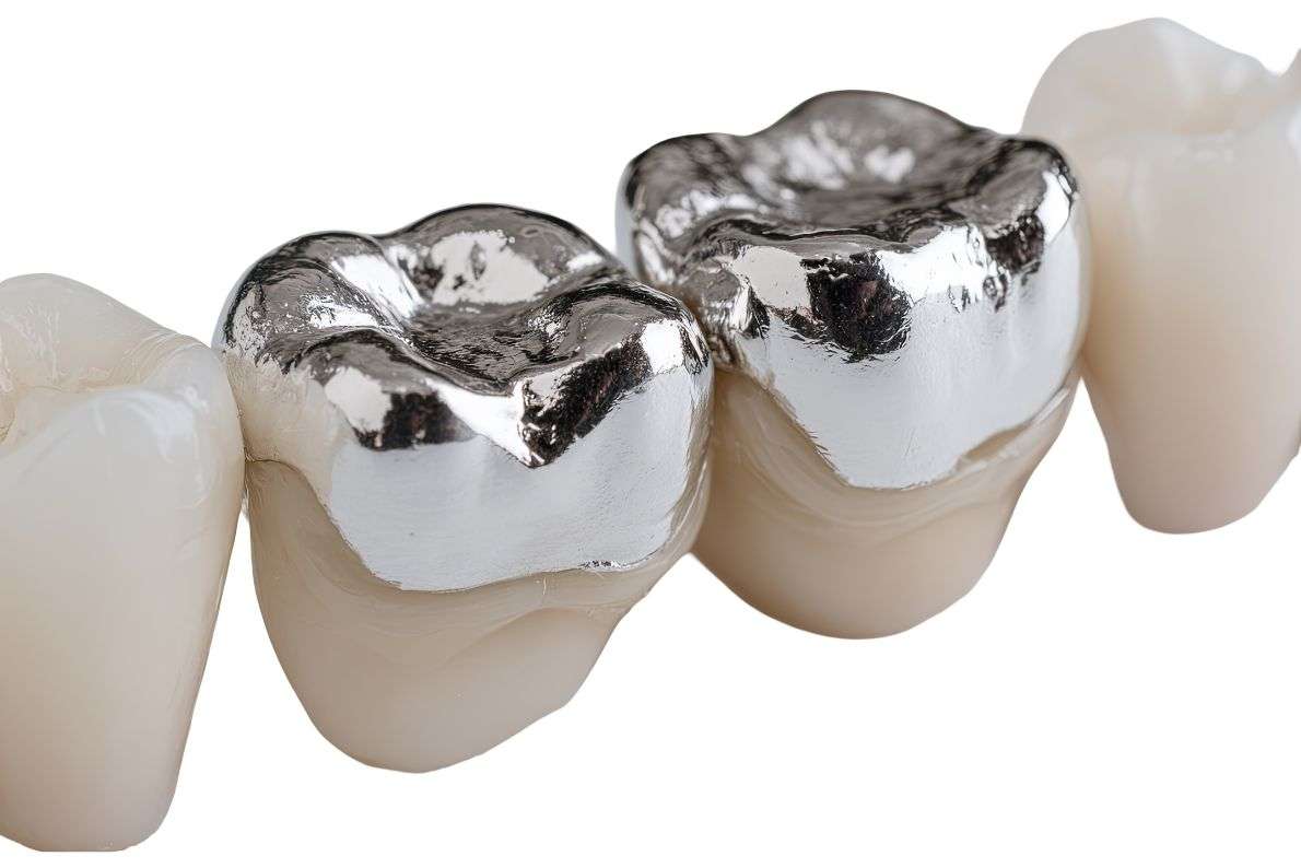 Porcelain vs Metal Dental Crowns: Which Is the Right Choice?