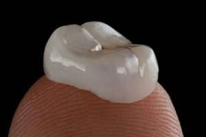 What Is a Dental Crown After Root Canal Treatment - StormDental