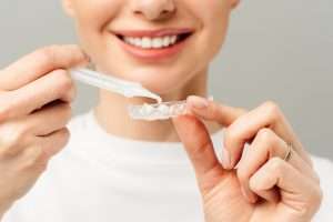 Can a Scale and Polish Remove Stains from Your Teeth - StormDental
