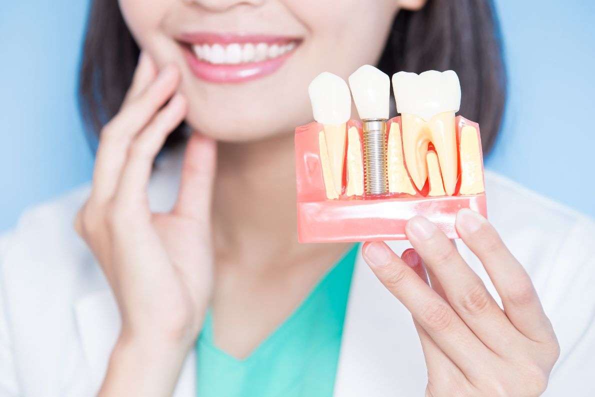Can You Get Dental Implants on the NHS?