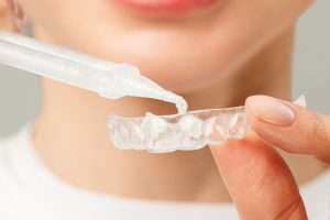 How Long Do Take-Home Whitening Results Last - StormDental