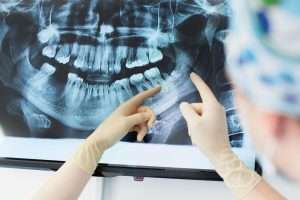 NHS Dental Care for Pregnant Women - StormDental