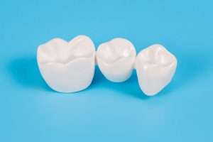 What Are Your Tooth Replacement Options After an Extraction - StormDental