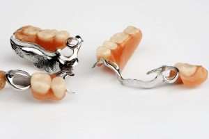 What Are Your Tooth Replacement Options After an Extraction - StormDental