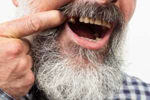 What Are Your Tooth Replacement Options After an Extraction - StormDental