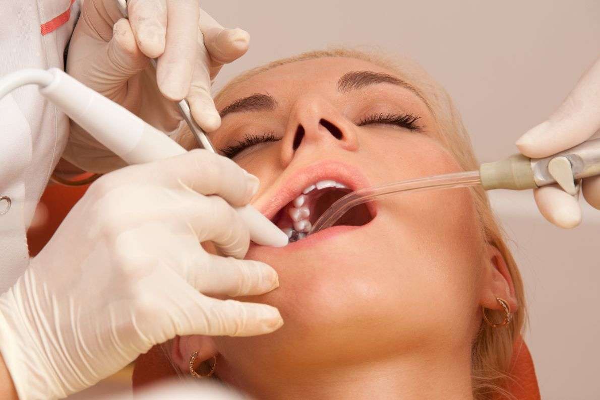Can Scale and Polish Help with Bad Breath?