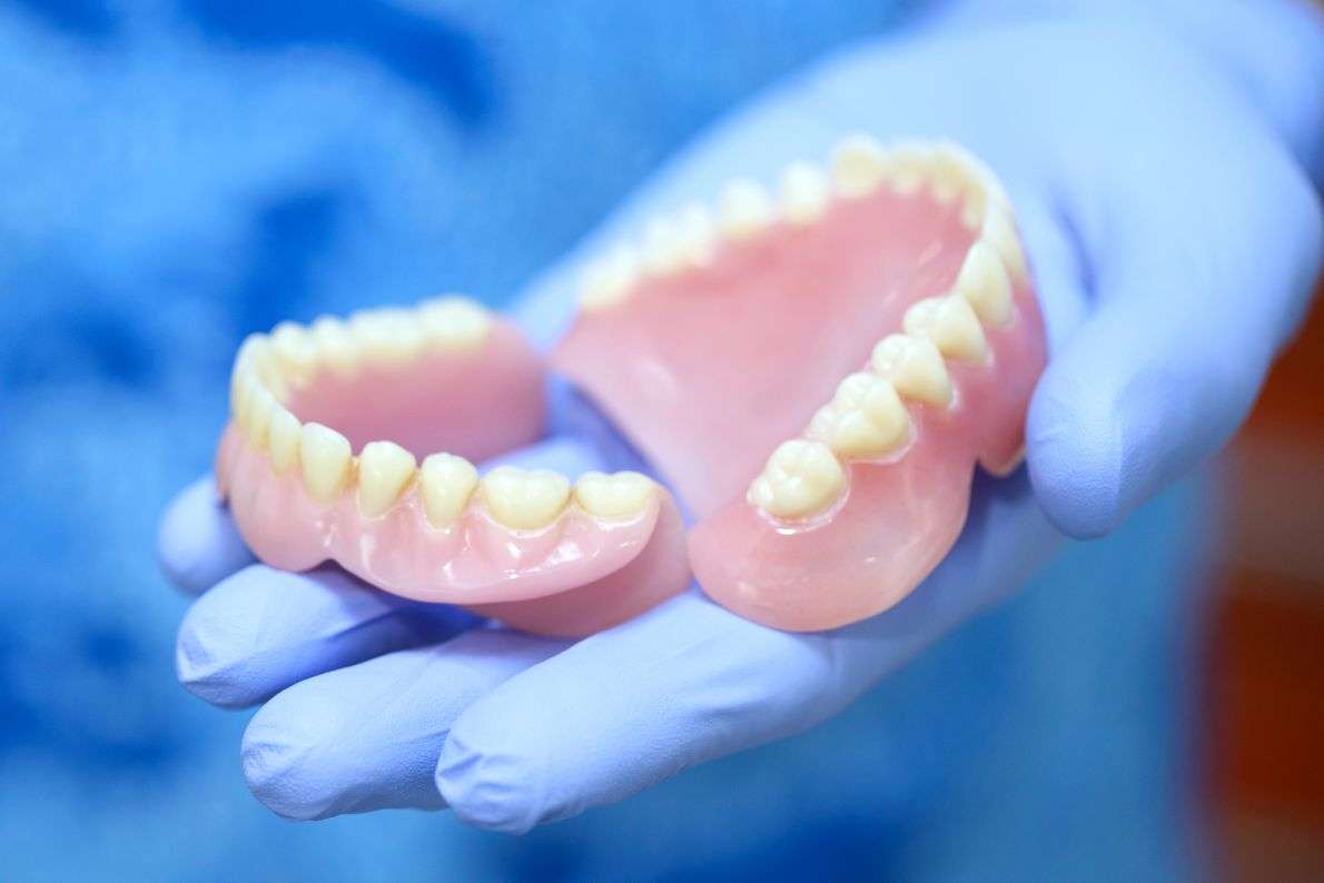 How Are Dentures Made and Fitted at StormDental in Dreghorn?