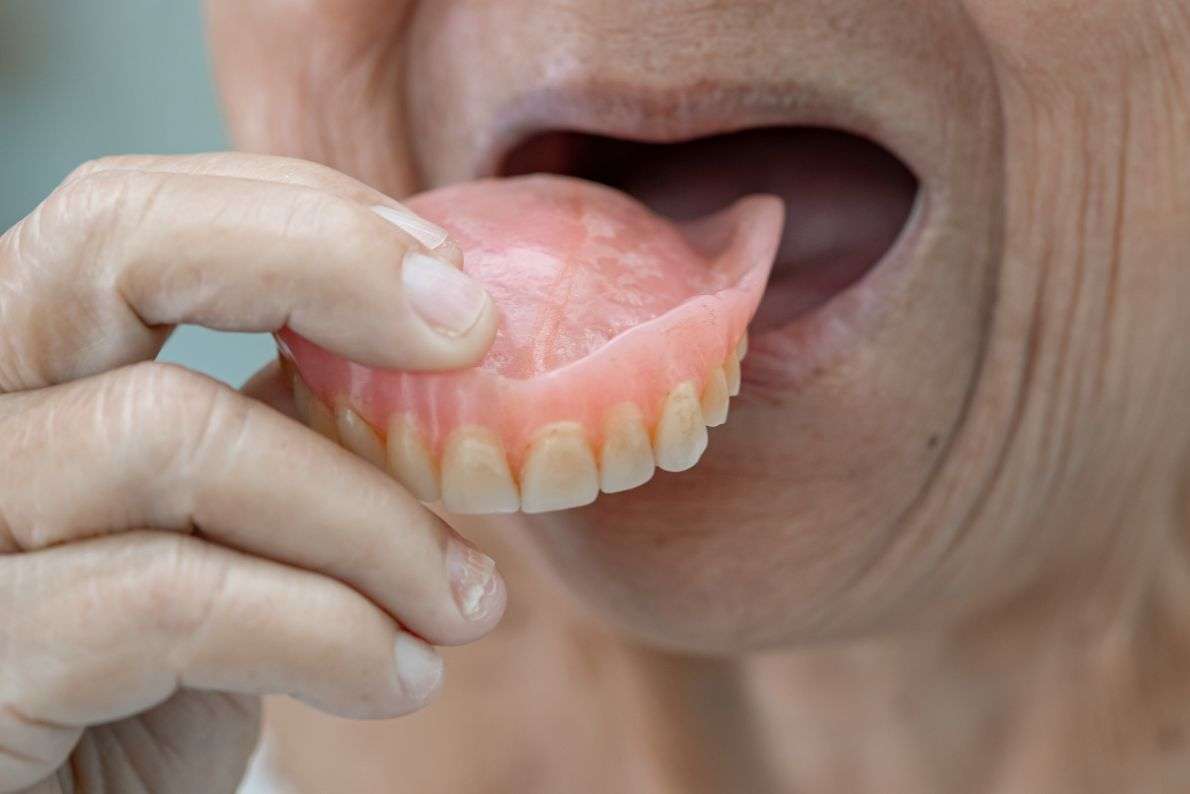 How Dentures Can Restore Confidence and Quality of Life