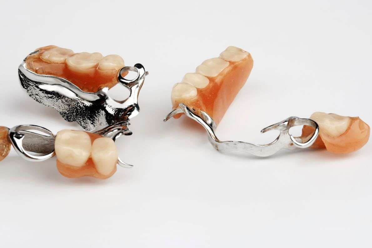 How Long Do Dentures Last and When Should They Be Replaced?