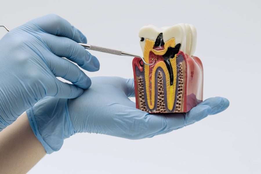How Long Does Root Canal Treatment Take?
