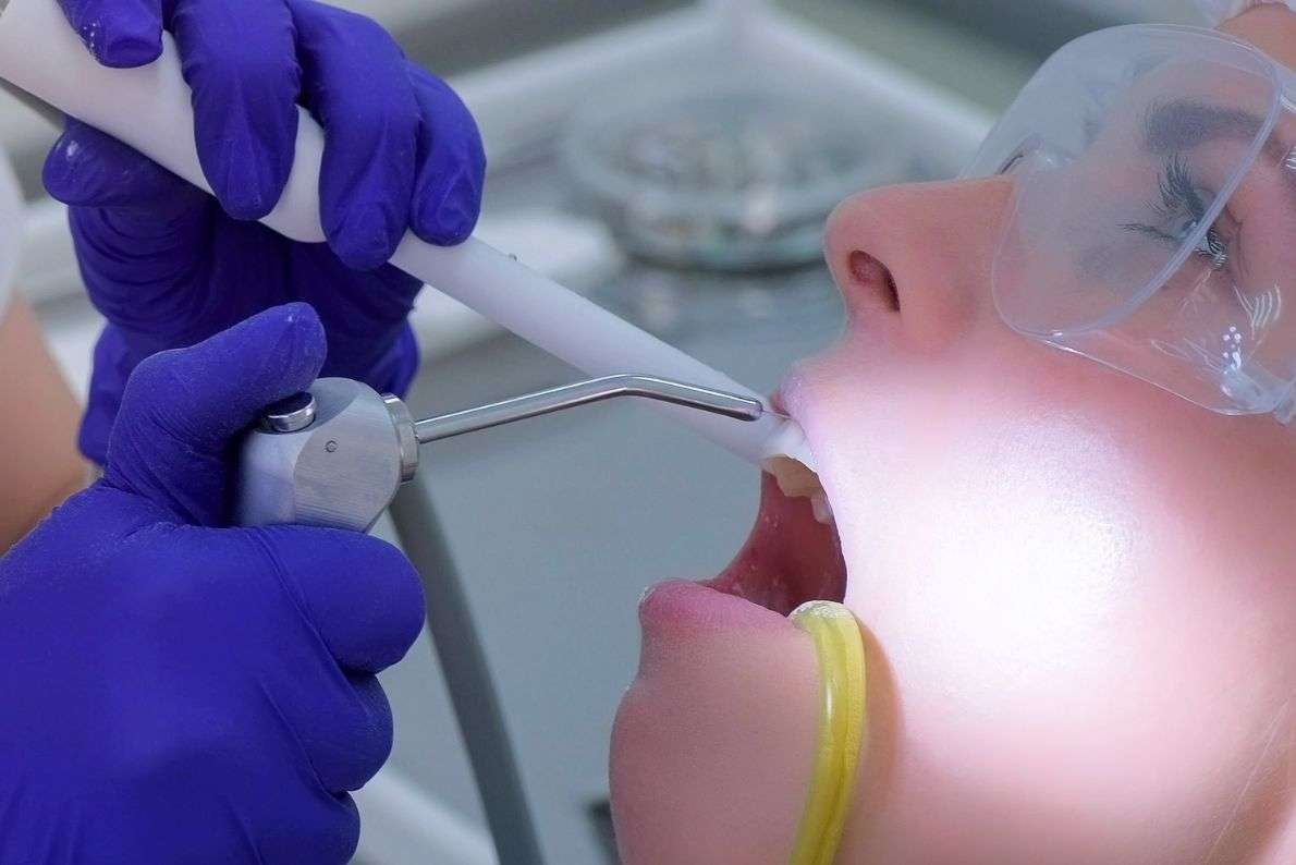 How a Scale and Polish Can Help Prevent Gum Disease?