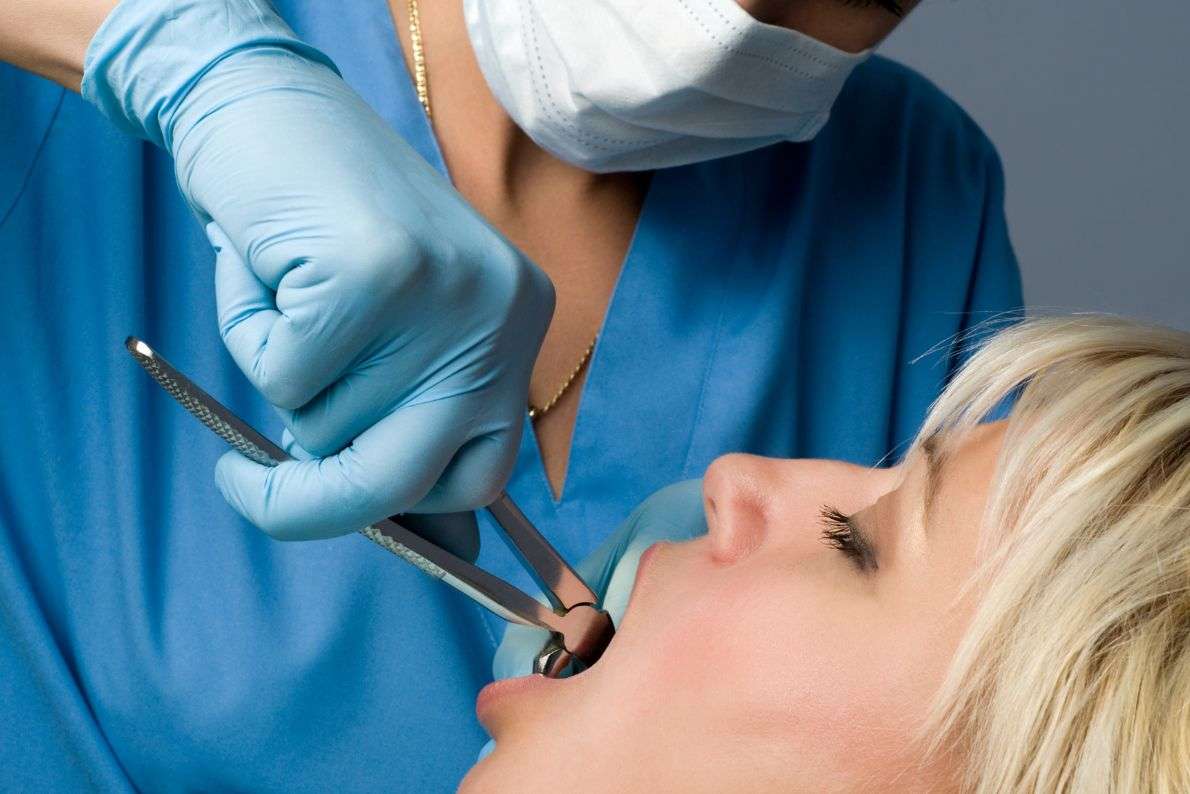 How to Manage Swelling After a Tooth Extraction