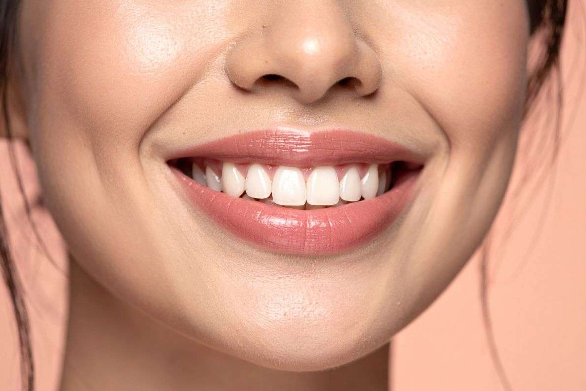 Is Take-Home Tooth Whitening Safe?