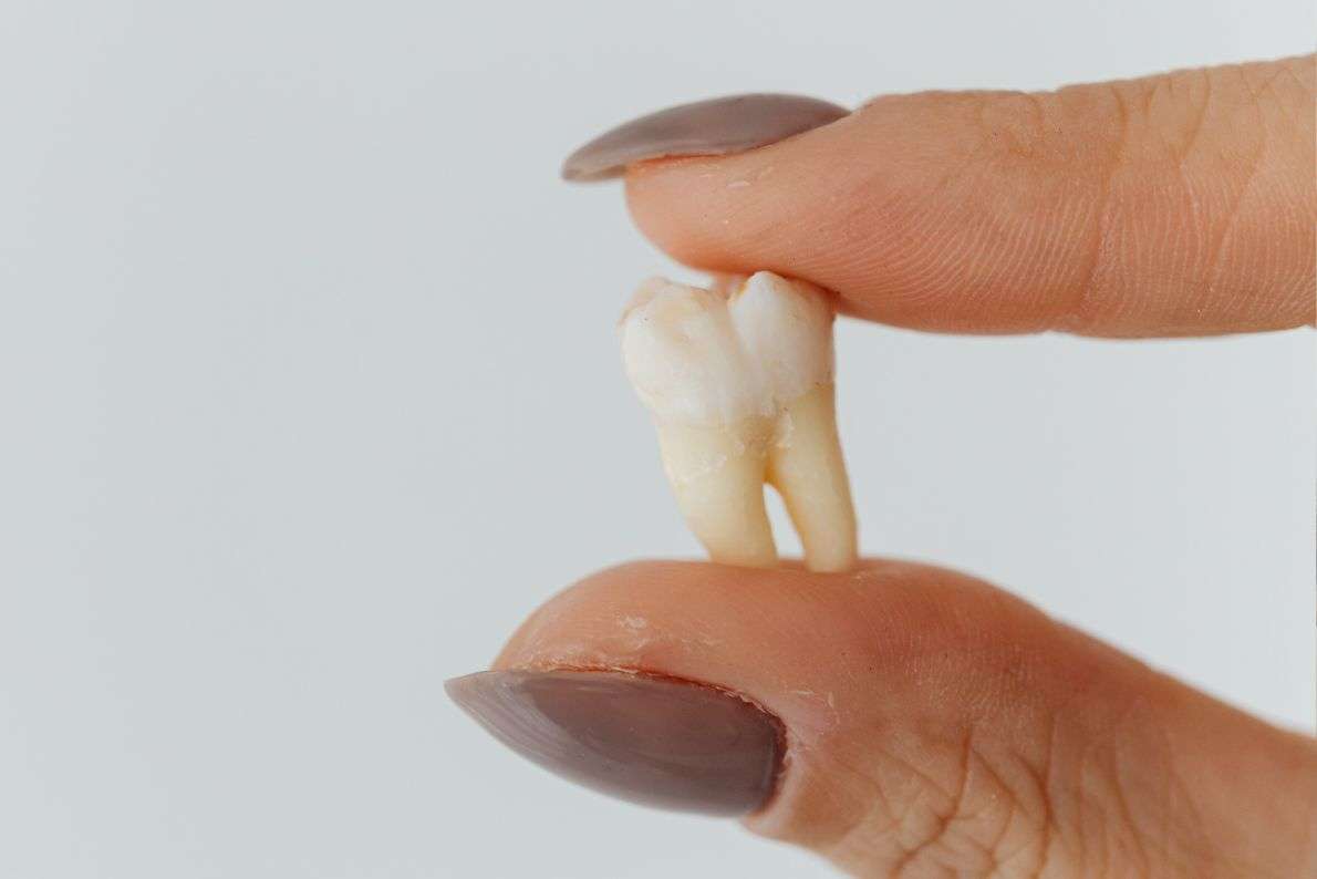 Tooth Extraction Aftercare: How to Heal Quickly and Safely