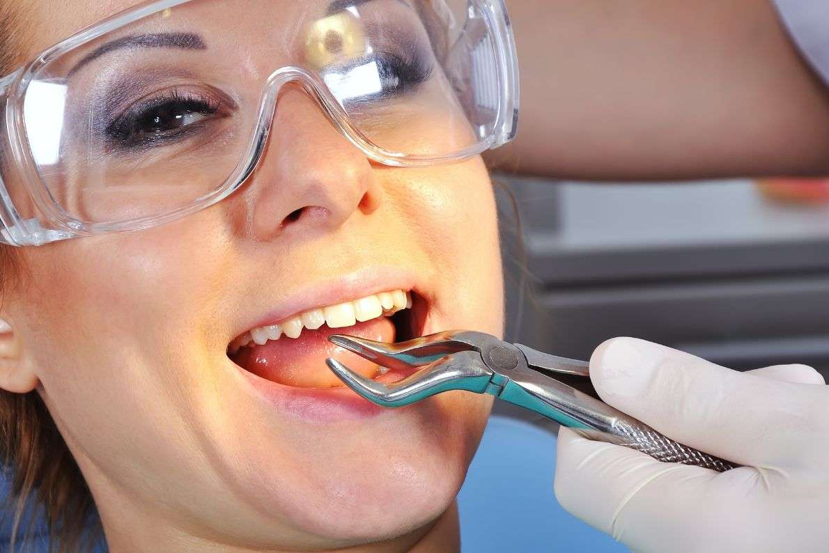 What Are the Risks of Surgical Tooth Extraction?