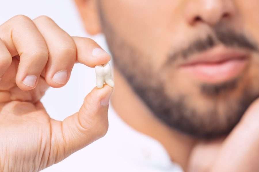What Is a Dry Socket and How Can You Prevent It After Extraction?