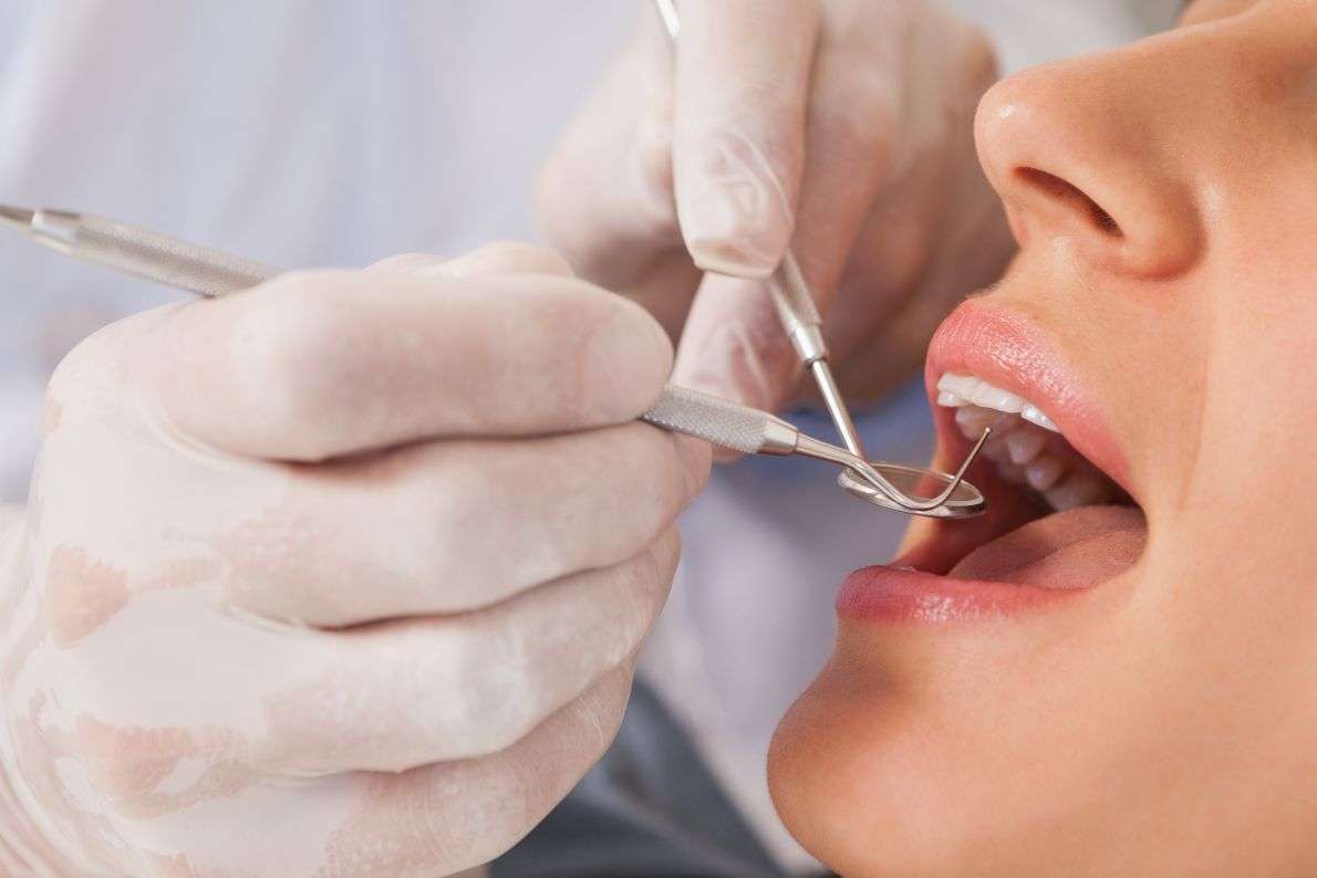 What to Expect from an NHS Dental Check-Up at StormDental