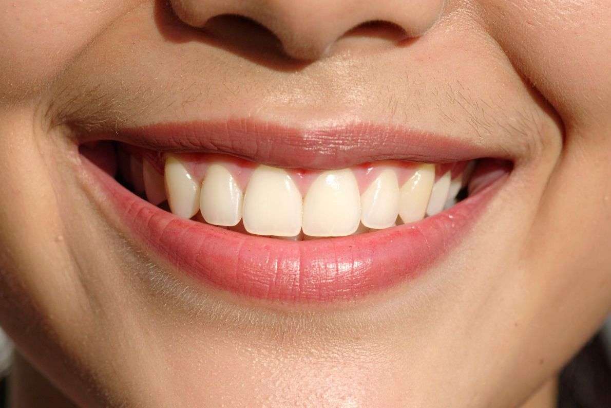 Who Is a Good Candidate for Tooth Whitening?
