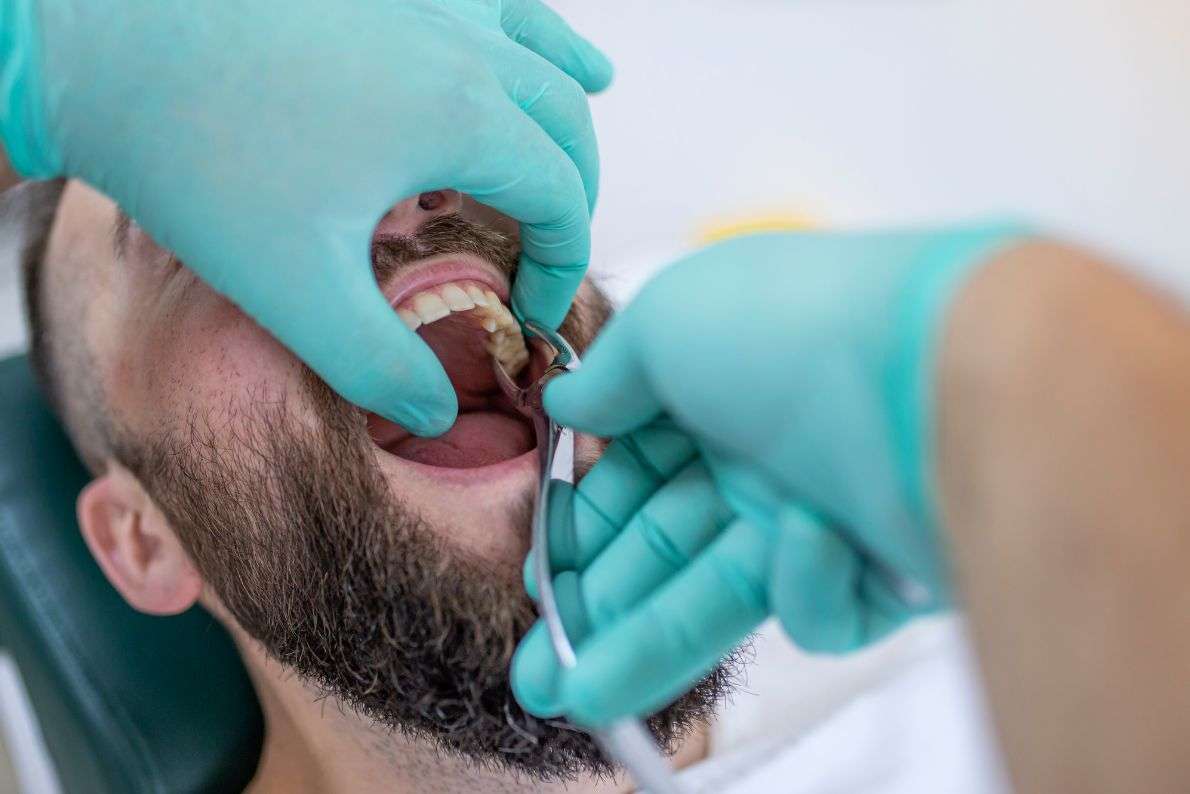 Why Leaving a Damaged Tooth Can Be More Harmful?