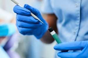 Why White Fillings Are Better for Your Tooth Structure